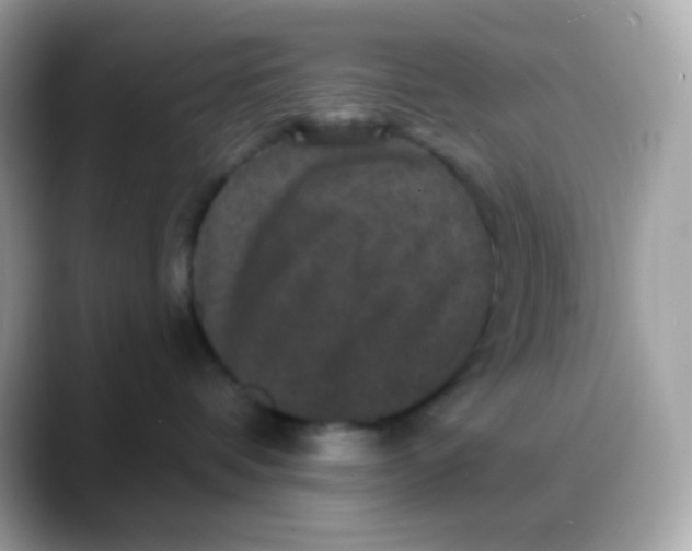 X0000088140336200706042014