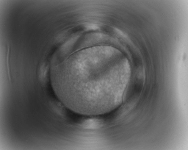 X0000088140364200706042014