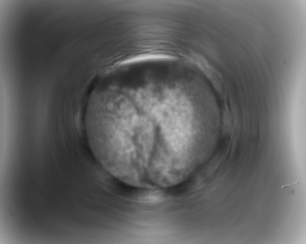 X0000088140377200706042014