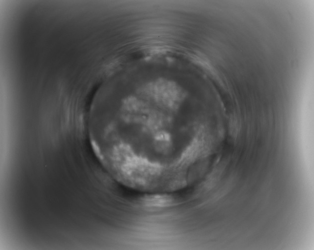 X0000088140378200706042014