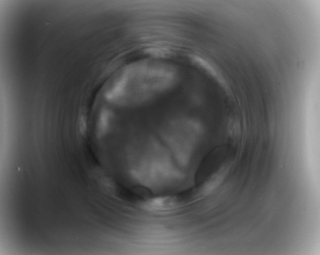 X0000088140382200706042014