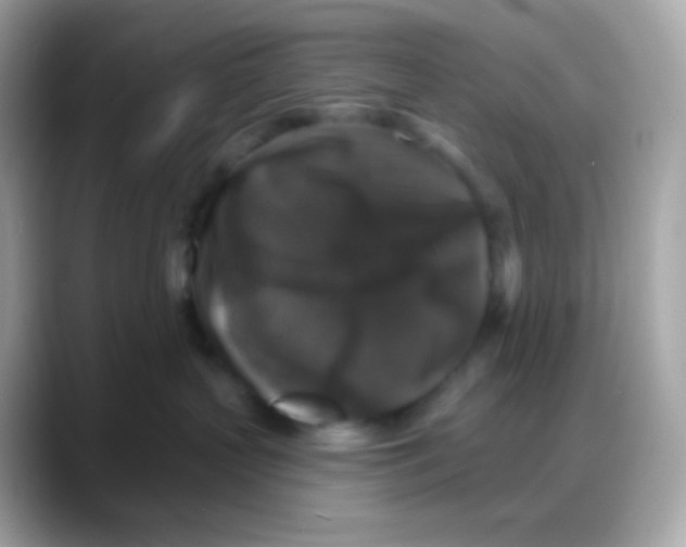 X0000088140383200706042014