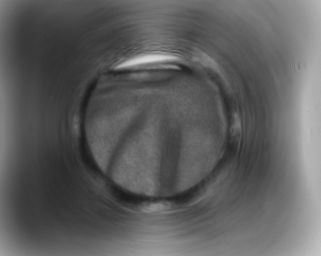 X0000088140452200706042012