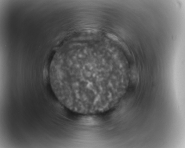 X0000088140523200706042011