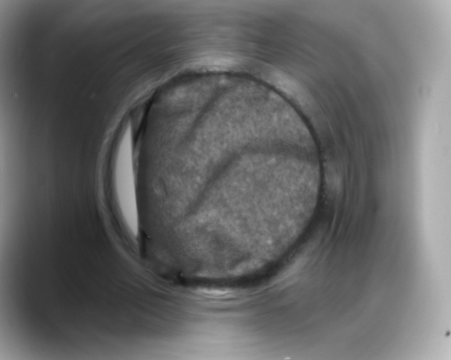 X0000088140582200706042011