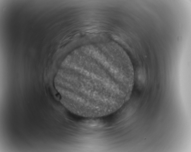 X0000088140615200706042010