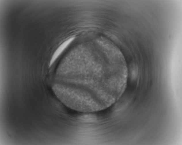 X0000088140619200706042010