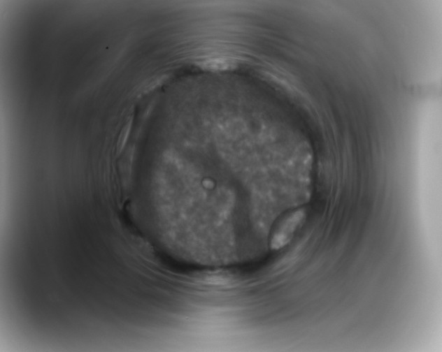 X0000088140652200706042010