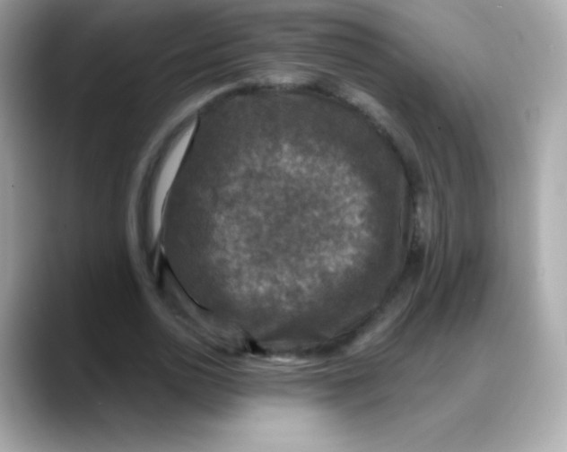 X0000088140726200706042008