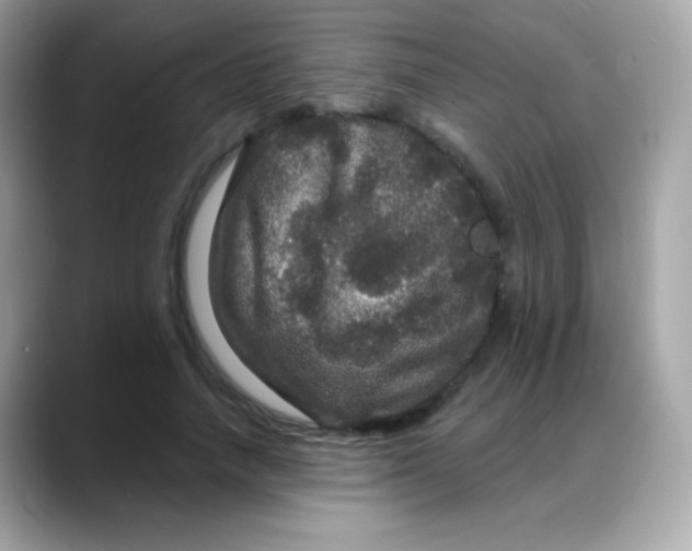 X0000088140738200706042008