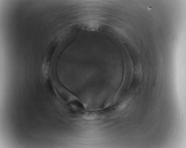 X0000088140818200706042007