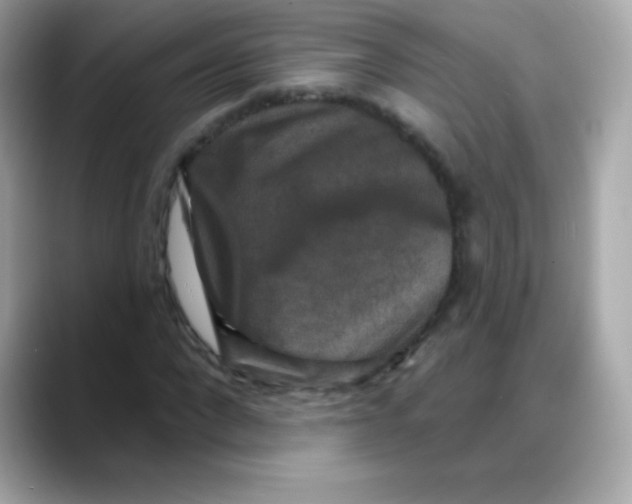 X0000088140872200706042007