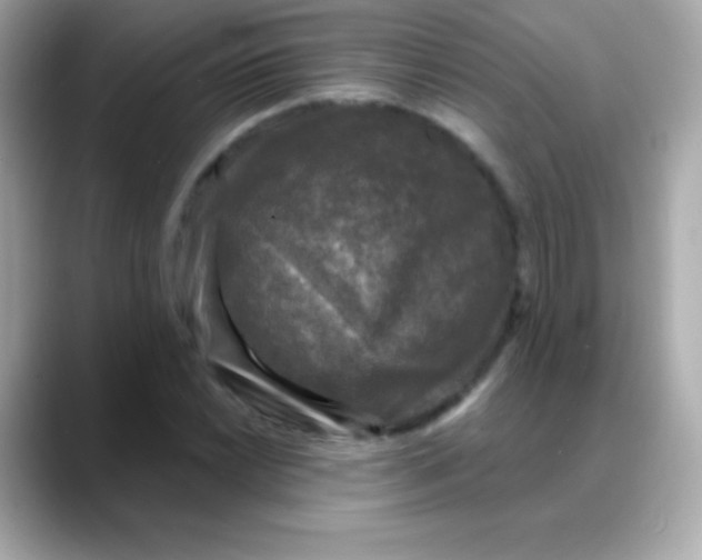 X0000088141022200706042005