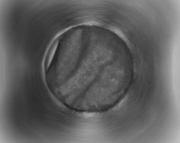 X0000088141032200706042005