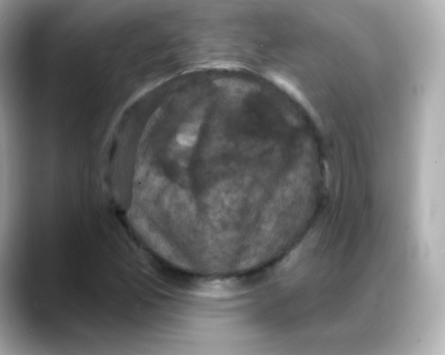 X0000088141165200706042003