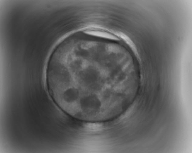 X0000088141183200706042003