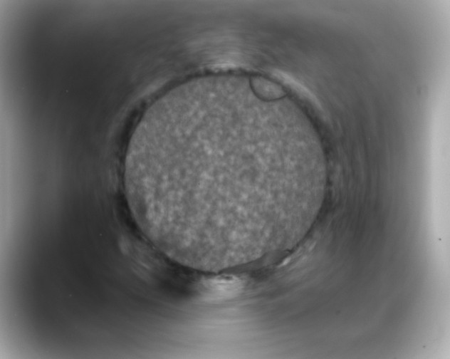 X0000088141207200706042002