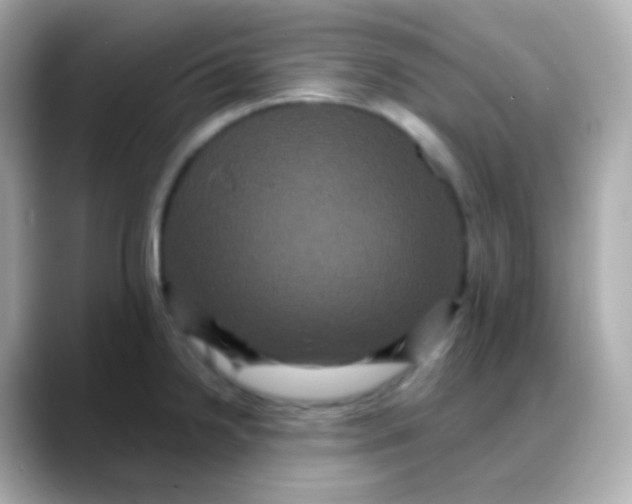 X0000088141238200706042002