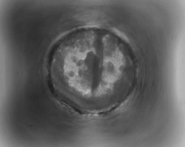 X0000088141400200706041959