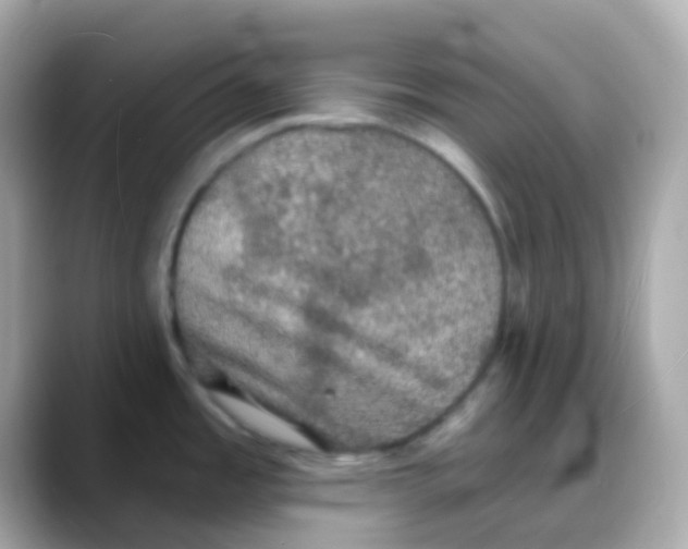 X0000088141485200706041959