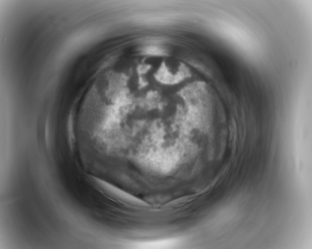 X0000088141487200706041959