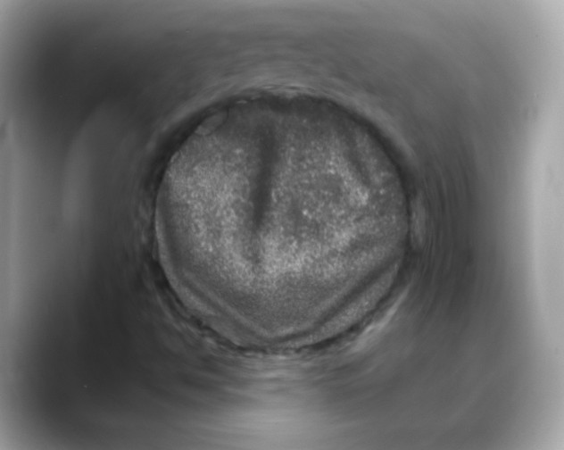 X0000088141494200706041958