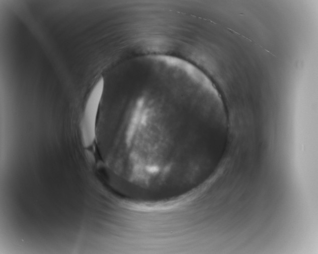 X0000088140017200706111433