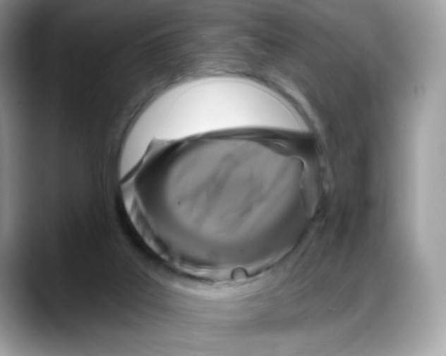 X0000088140019200706111433