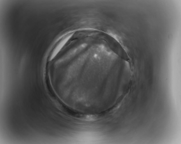 X0000088140056200706111433