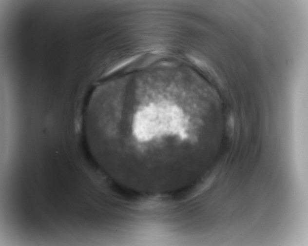 X0000088140072200706111433