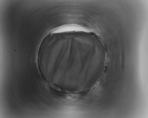 X0000088140099200706111432