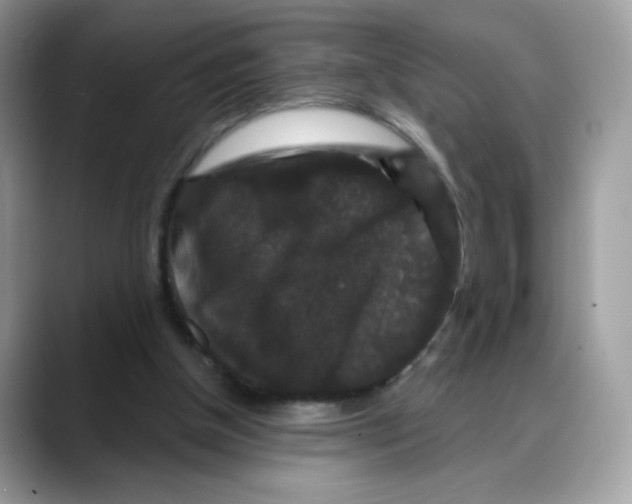 X0000088140154200706111431