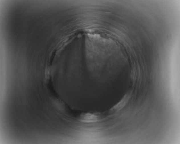 X0000088140180200706111432