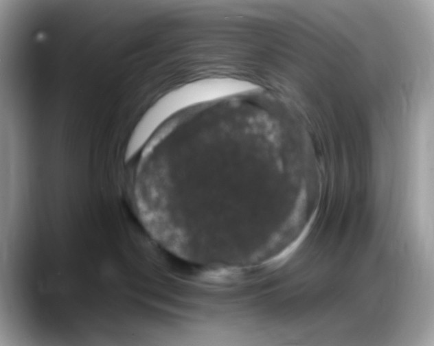 X0000088140190200706111432