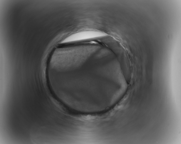 X0000088140197200706111431