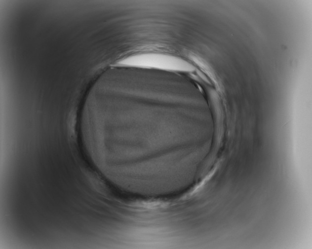 X0000088140201200706111431