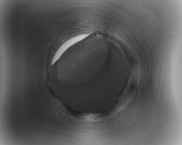 X0000088140229200706111431