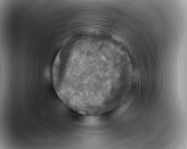 X0000088140238200706111431