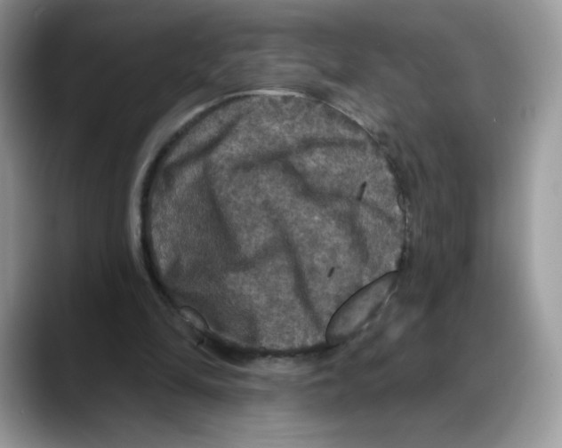 X0000088140294200706111430