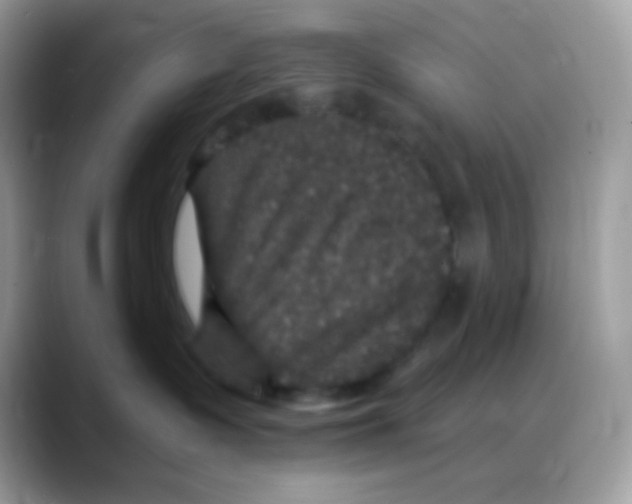 X0000088140335200706111430