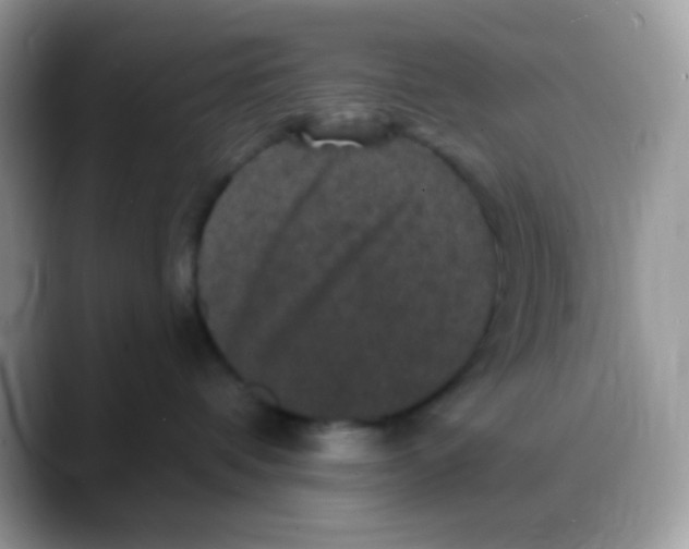 X0000088140336200706111430