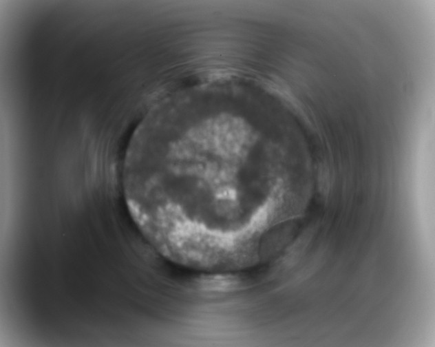 X0000088140378200706111430