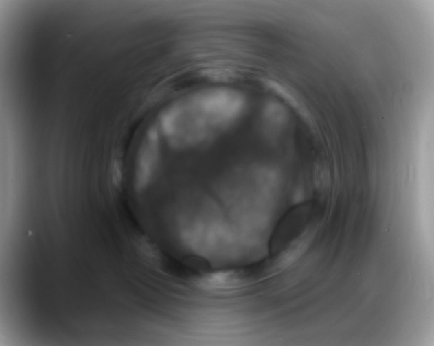 X0000088140382200706111430