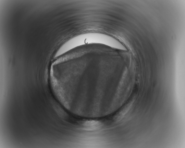 X0000088140397200706111429