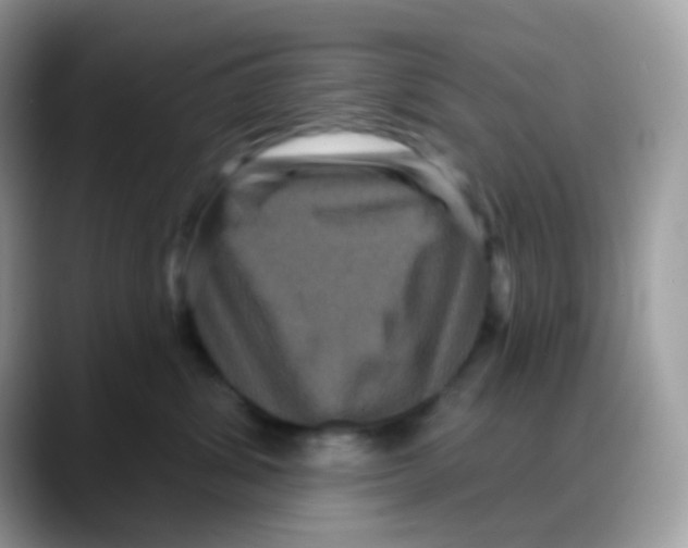 X0000088140428200706111429