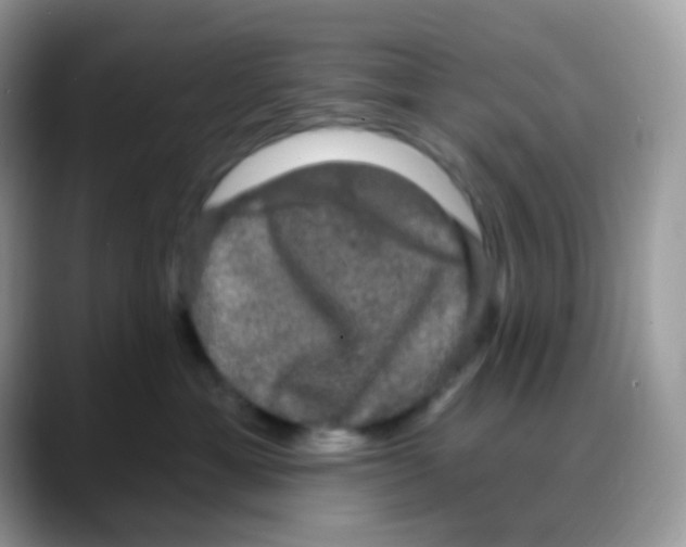 X0000088140429200706111429