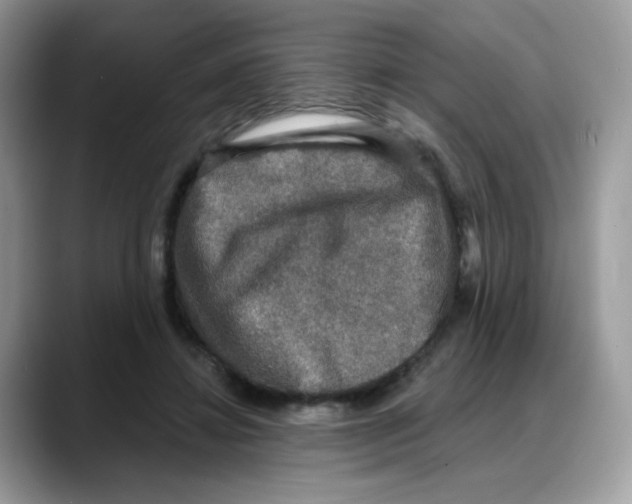 X0000088140452200706111428