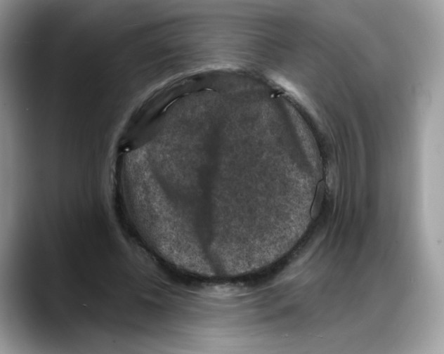 X0000088140540200706111427