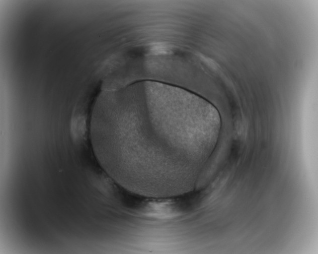 X0000088140560200706111427