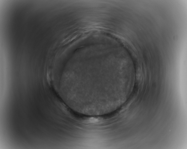 X0000088140566200706111427